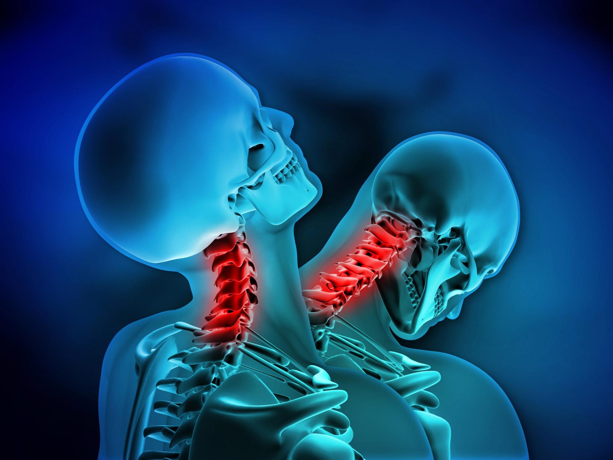 pain-in-the-neck-common-neck-injuries-explained-norman-geisler